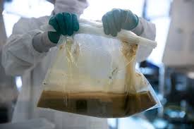 Image result for Fecal Transfer