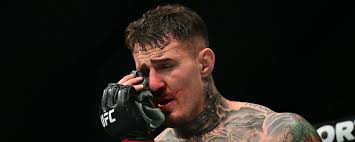 James Bateman (%{weight}) MMA Profile