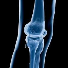 Image result for Knee XRay