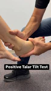 Image result for Talar Tilt