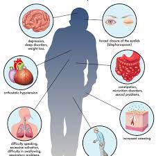 The main symptoms of parkinson's disease are usually stiffness, shaking (tremor), and slowness of movement. Parkinson S Disease Early Symptoms And When To See A Neurologist Neurology Associates