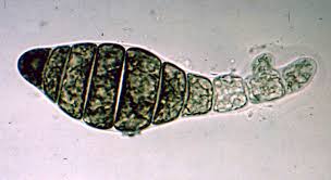 Image result for Polystachya caloglossa