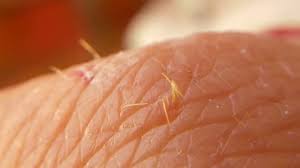 If the dog has spines in different areas of the body, apply antibiotic ointment in one section. Little Cactus Spines Removal Youtube