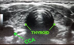 Radiology Time Timeradiology Twitter