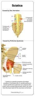 Pin On Home Remedies