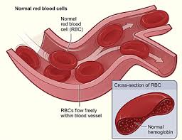 We did not find results for: Hemolytic Anemia Wikipedia