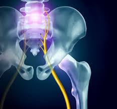 Deep Gluteal Syndrome Treatment In Springfield Back Body Pain Relief