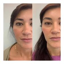 Dr Sillett Aesthetics added a new...