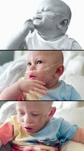 Want to see a Miracle? Watch this Baby grow against all odds and his smile  light up some of our lifetime's darkest days