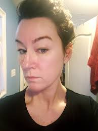 Hey everyone, just wondering if I could ask for some advice. I'm just  wondering if gluten intolerances can manifest in skin, particularly the  skin