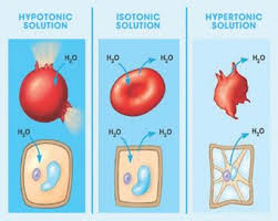 Iv Solution Chart Hypotonic Isotonic And Hypertonic