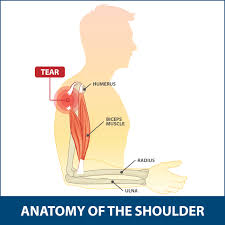 It is the major joint connecting the upper limb to the trunk. Bicep Tendon Tear Info Florida Orthopaedic Institute