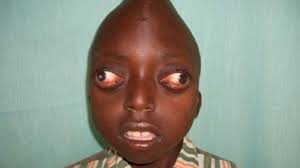 12 People With Bigger Than Normal Body Parts!