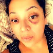 SKINZONE MEDICAL: HANNAH VU, MD