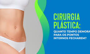 Pontos Internos Plastica Em Quanto Tempo Fecham Blog Master Health
