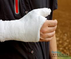 Image result for Fracture