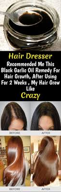 Phosphoric acid cures the progressive thinning of hair, which has caused because of lot of stress and grief. My Hair Dresser Recommended Me This Black Garlic Oil Remedy For Hair Growth After Using For 2 Week Hair Remedies For Growth Garlic For Hair Growth Hair Growth