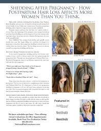 An easy way to tell the difference between a broken hair and shed hair is. So Scottsdale May 2018 By Richman Media Group Issuu
