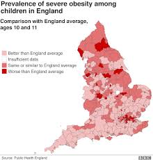 one in 25 children aged 10 or 11 severely obese bbc news