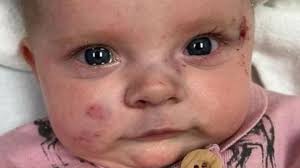 How you can help family of 2-month-old girl who died of a brain injury in  the tornado