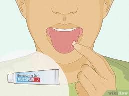 Image result for mouth ulcer on tongue)