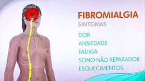 Como aliviar as dores da Fibromialgia - Dra. Fabiana Arruda | Saúde Mental  em Goiânia