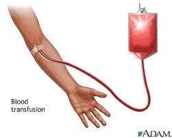 Image result for Blood Transfusion