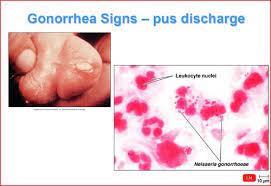 Microbiology Chapter 26 Flashcards Quizlet
