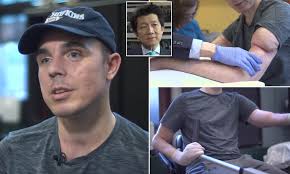 US Army veteran, 35, undergoes double arm transplant following roadside  explosion