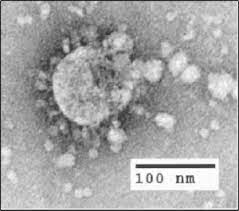 Berikut ini adalah beberapa langkah pencegahan asas yang dapat menurunkan risiko pendedahan penyakit berjangkit di tempat perawatan kesihatan Severe Acute Respiratory Syndrome Wikipedia