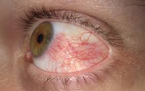 Image result for Pseudoeriosema