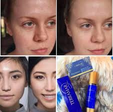 💛Terramar💛 en promoción hasta julio 31 ¿Tienes Problemas con piel  brillosa y poros abiertos? 💛Prueba esta Loción Facial Matificante con FPS  15 💛 💙 Loción ligera que matifica al instante por su