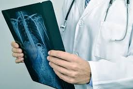 Selanjutnya setelah membaca jabaran diatas apa yang dimaksud tulang rusuk, saatnya. Kenali Risiko Berbahaya Akibat Patah Tulang Rusuk Alodokter