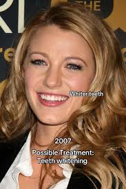 Blake Lively Smile