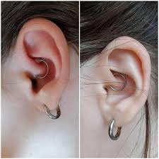 Place the ball somewhere clean that it will not roll away (a tray is preferred) while you insert the ring. Daith Piercing Bump Before And After Piercing