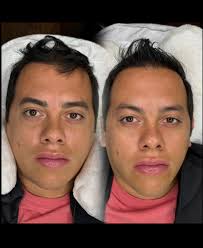 𝔸𝕥𝕣é𝕧𝕖𝕥𝕖 𝕒 𝕧𝕚𝕧𝕚𝕣 𝕝𝕒 𝕖𝕩𝕡𝕖𝕣𝕚𝕖𝕟𝕔𝕚𝕒! 𝐄𝐟𝐞𝐜𝐭𝐨𝐬  𝐬𝐢𝐧 𝐥í𝐦𝐢𝐭𝐞𝐬! 𝐒𝐨𝐥𝐨 𝐜𝐨𝐧 𝐥𝐚 𝐦𝐞𝐣𝐨𝐫 𝐭é𝐜𝐧𝐢𝐜𝐚 💫 ...  #microblading #phibrowsacademy #phibrows #boldbrows #cdmx #maquillaje #pmu  #makeup #cejasmexico ...