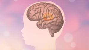 Is mskcc doing, or do you know anyone who is doing, genetic research on gbm? Treovir S Oncolytic Virus Product Extends Survival In Children With Brain Tumors Biospace