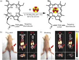 Image result for Porfimer