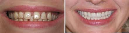 Fun loving dental clinic looking for like minded people. Predictably In Meeting Patient S Expectations For Esthetic Dentistry