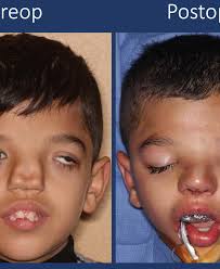 Dr David Yates MD DMD FACS