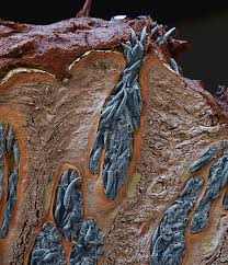 Image result for Demodex folliculorum