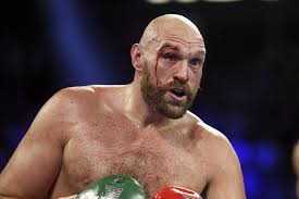Tyson fury was born in wythenshawe, manchester. Tyson Fury Thinks Conor Mcgregor Returning To Boxing Would Be Great Bleacher Report Latest News Videos And Highlights