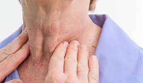 اعراض التهاب الغدة الدرقية وعلاجها