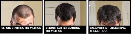 The average person loses about 100 strands per day, but as times goes on, that number grows and grows. The 15 Best Foods For Healthy Hair Growth Nicehair Org