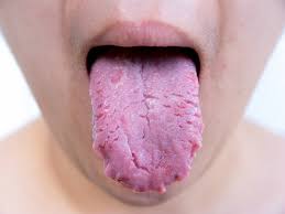Some of the most common oral cancer symptoms and signs include: à®‡à®³ à®žà®° à®•à®³ à®‰à®™ à®•à®³ à®¨ à®• à®• à®± à®• à®†à®ªà®¤ à®¤ à®® à®¨ à®• à®• à®• à®± à®µ à®¤ à®¤ à®¤ à®• à®• à®® à®¨ à®• à®• à®ª à®± à®± à®¨ à®¯ Tongue Cancer Causes Symptoms Prevention Tamil Boldsky