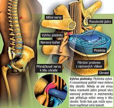 Image result for vyhřezlá ploténka