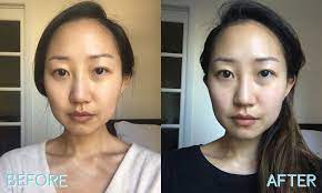 Finden sie clear skin auf gigagünstig! Does Drinking Water For Skin Improvements Actually Work The Klog