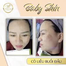 Top 10 Spa làm đẹp uy tín và chất lượng nhất TP. Tam Kỳ, Quảng Nam