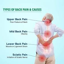 Can we establish a lower bound? Back Pain Is Increasingly Becoming A Major Health Concern The Type Of Pain Areas Impacted Depend On The Nerves Affected Can Begin From The Upper Neck Region Go All