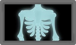 Affordable and search from millions of royalty free images, photos and vectors. X Ray Cartoon Openclipart